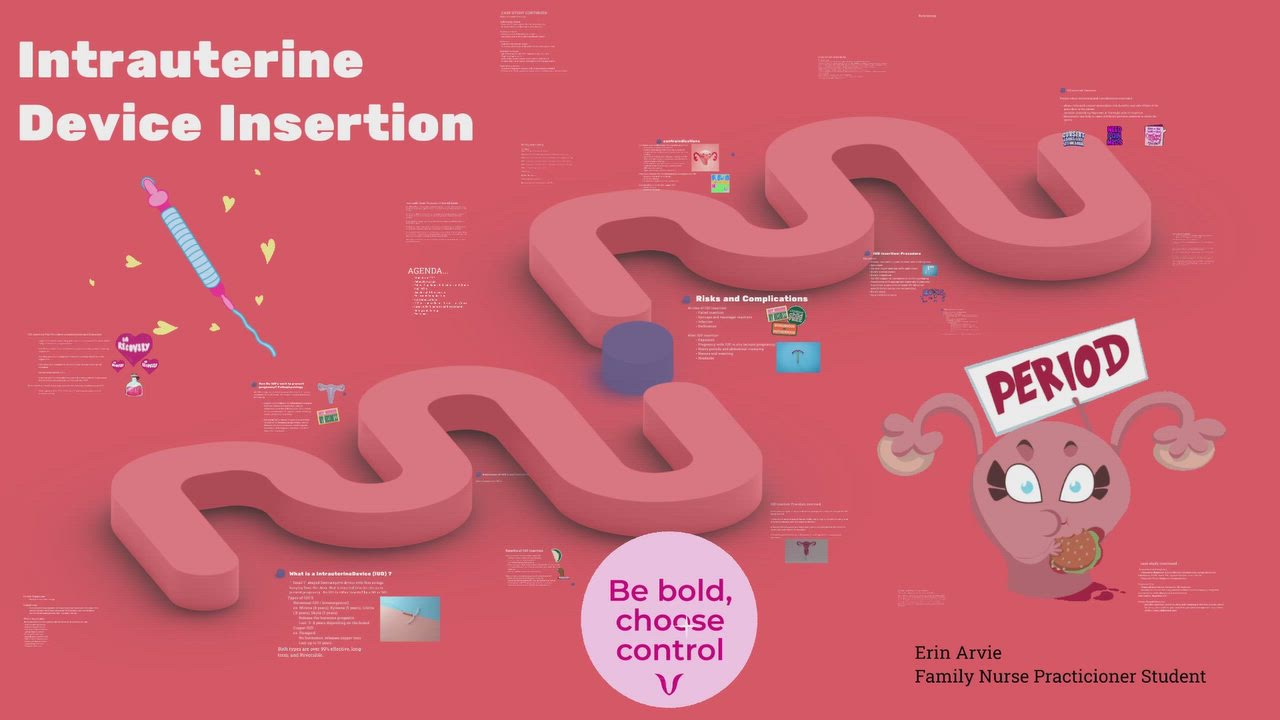 Intrauterine Device Insertion by Erin Arvie on Prezi Video